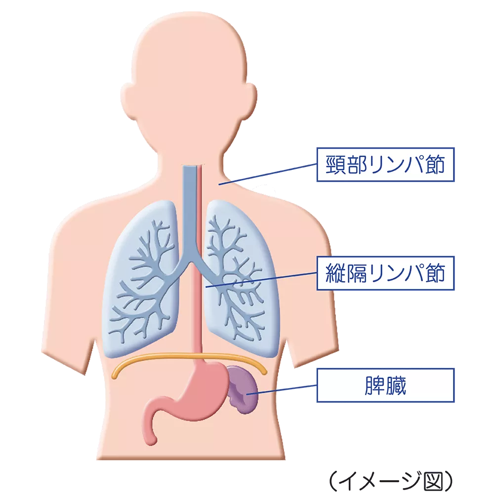drs_net_ic07_03.png
