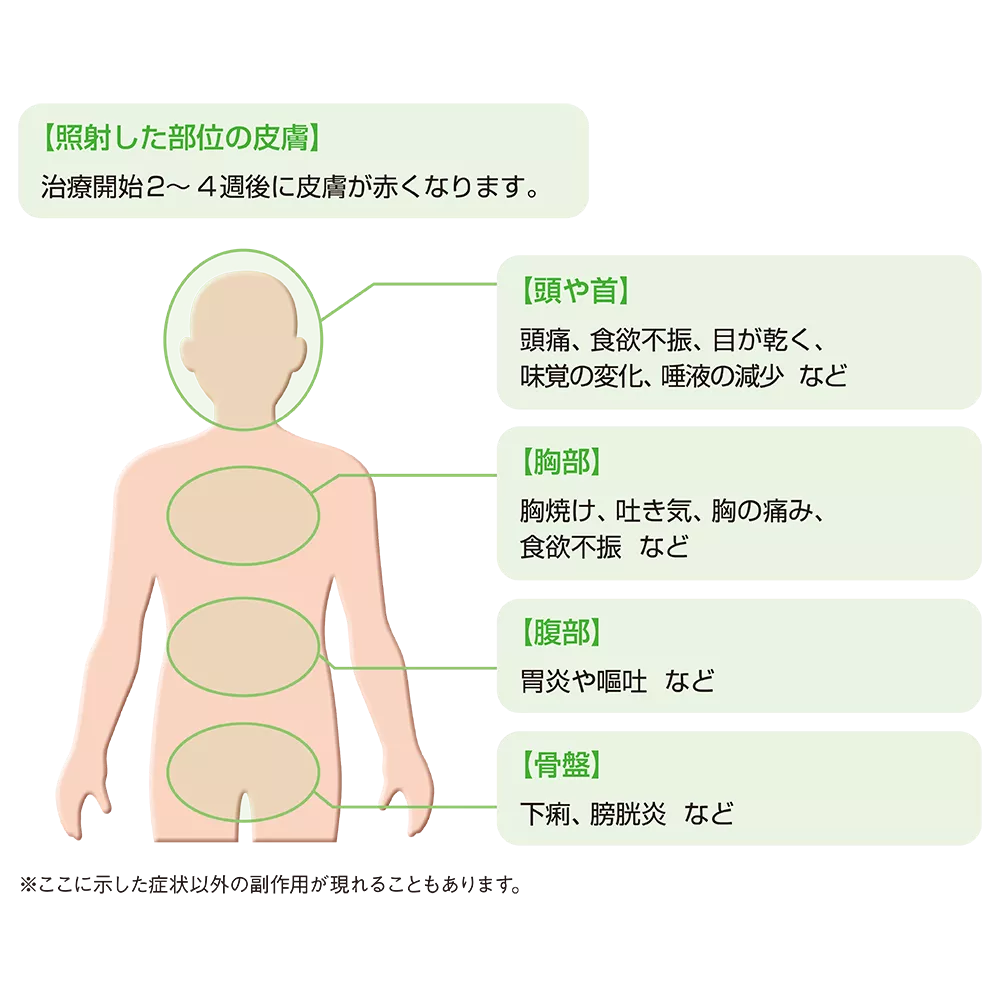 drs_net_ic08_04_rev.png drs_net_ic08_04_rev.png