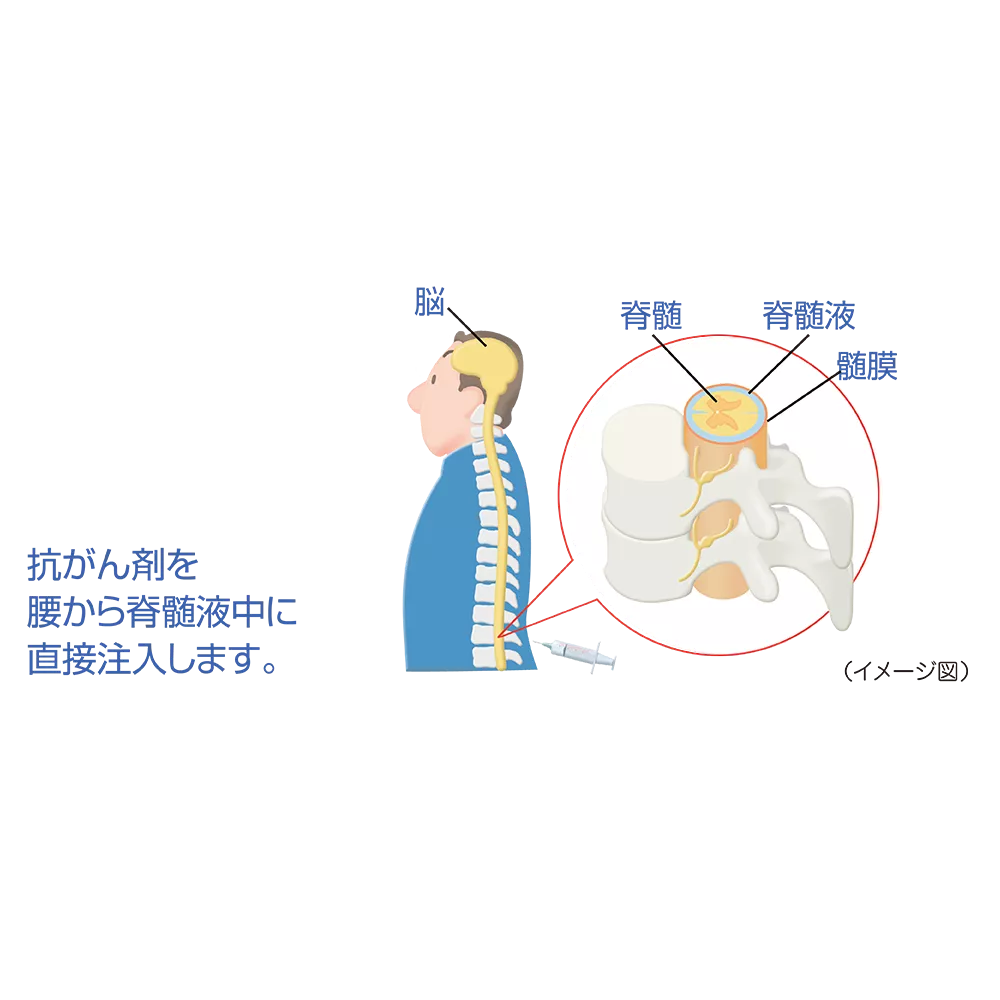 drs_net_ic08_06_rev.png drs_net_ic08_06_rev.png