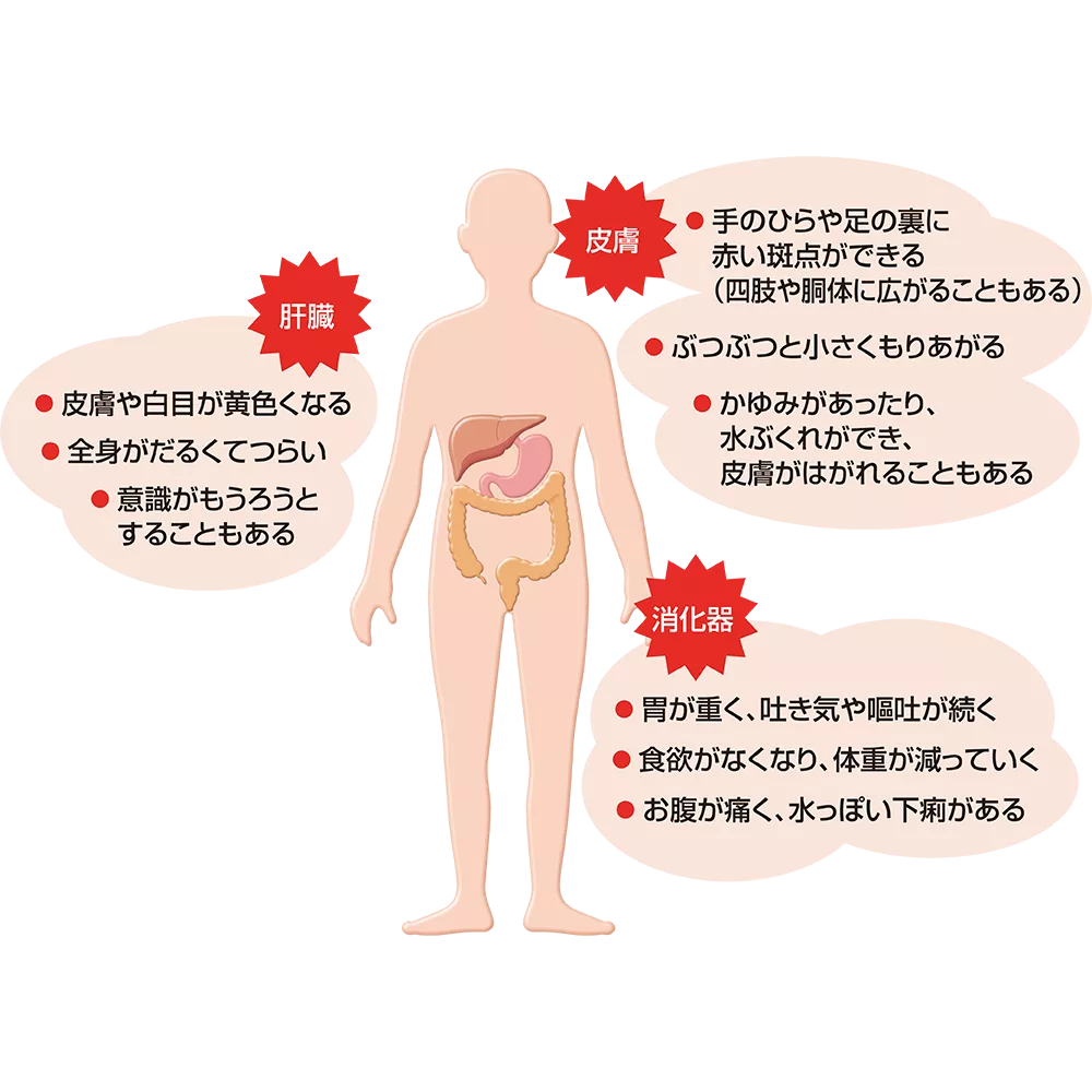 drs_net_ic17_05.png drs_net_ic17_05.png