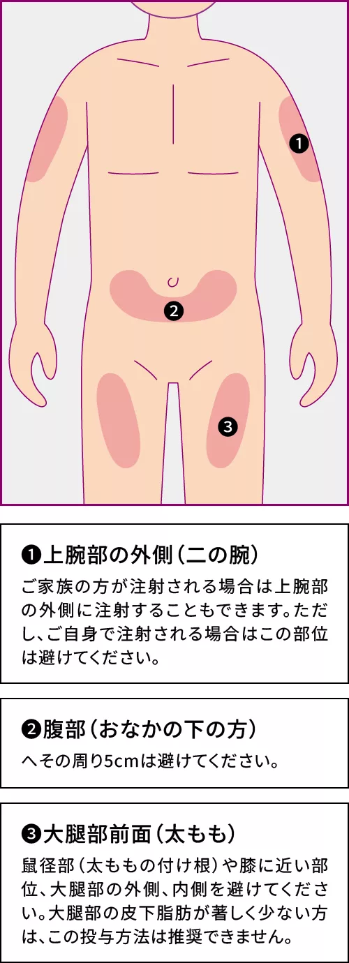 ゾレアの投与部位、皮下注射とは？