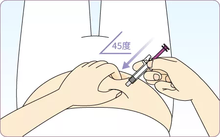 ゾレア皮下注75mg/150mgシリンジの投与方法②