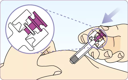 ゾレア皮下注75mg/150mgシリンジの投与方法④ 