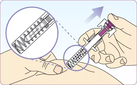 ゾレア皮下注75mg/150mgシリンジの投与方法⑤