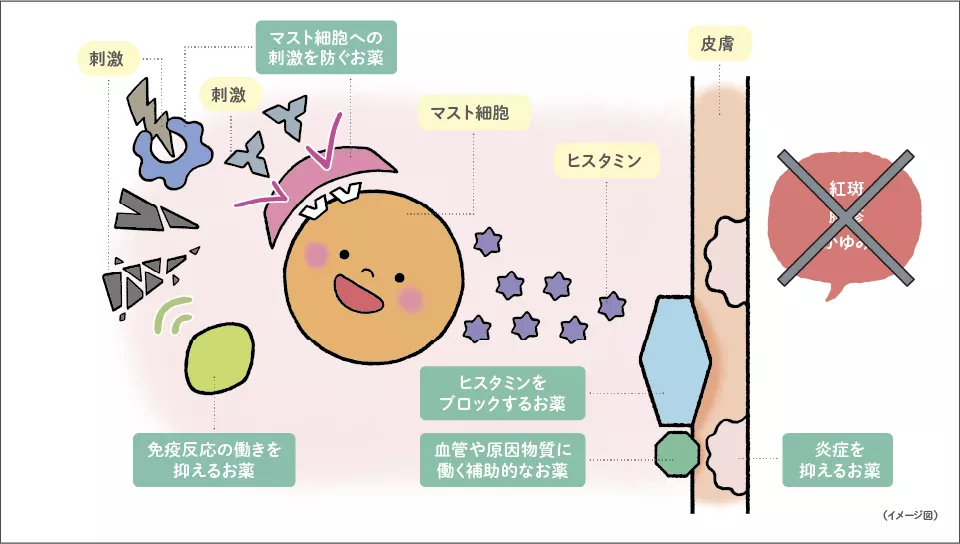 じんましんのお薬とは？イメージ図