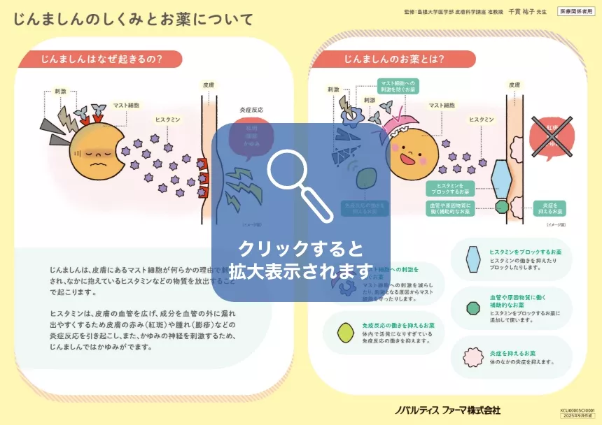 クリックすると拡大表示されます。 患者向け疾患解説ツール「おしえて！慢性じんましん」2枚目の画像