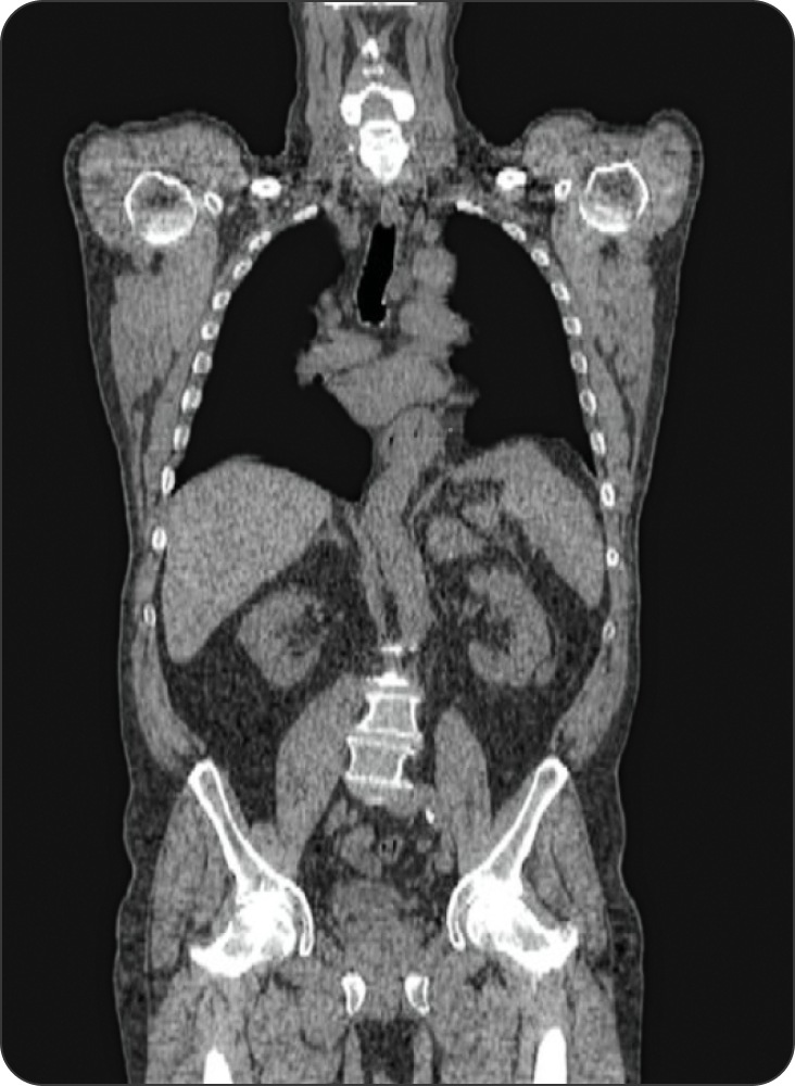 The benefits of RLT image 1 The benefits of RLT image 1