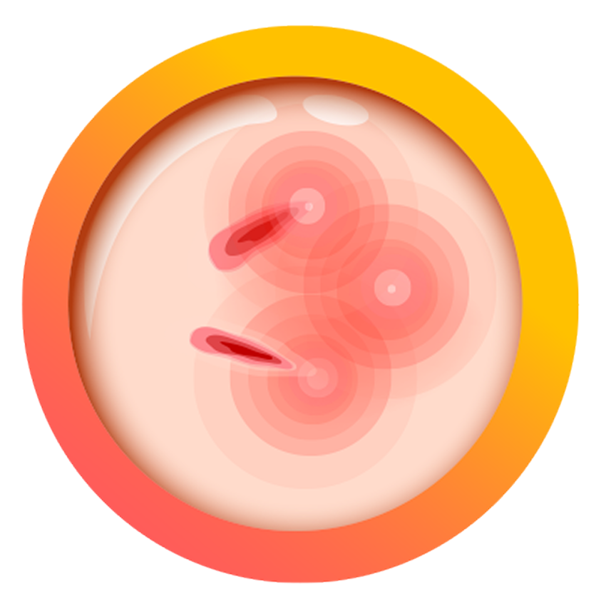 img img