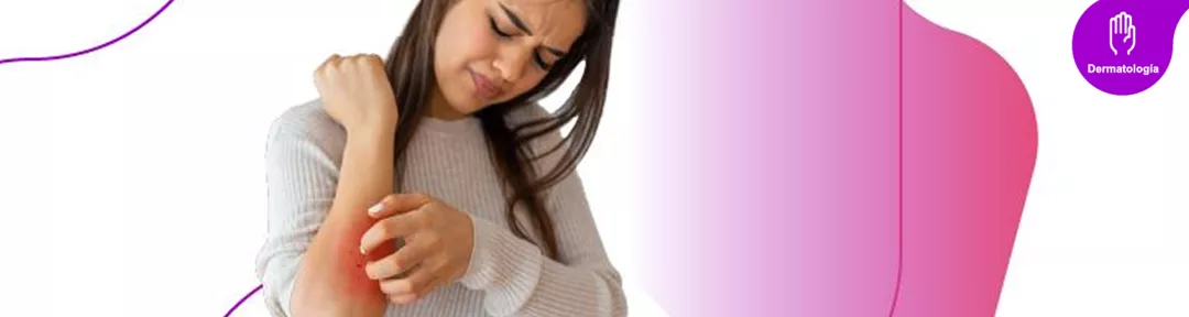 Conoce qué es la Psoriasis: Tipos, causas, tratamientos y más en NovartisPro, antes MedForum