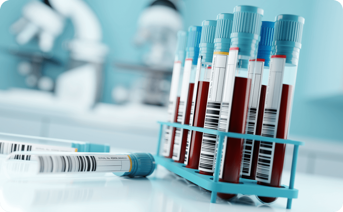 Waarom Lp(a) testen Novartis Cardiologie lipoproteine(a) (1) Waarom Lp(a) testen Novartis Cardiologie lipoproteine(a) (1)