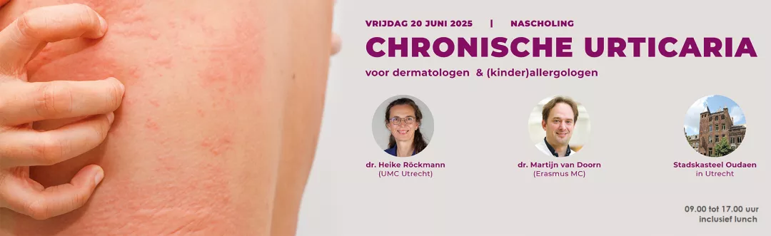Nascholing Chronische Urticaria Nascholing Chronische Urticaria