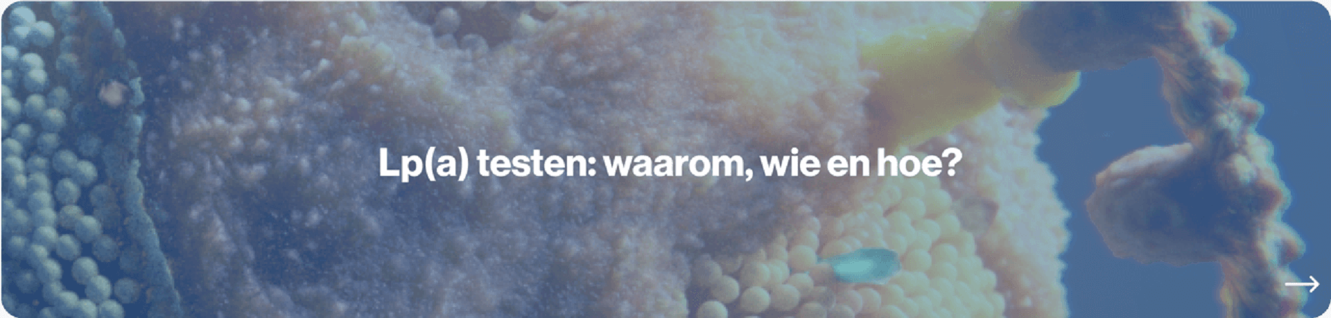 Lp(a) testen, waarom, wie, en hoe Novartis Cardiologie lipoproteine(a) 