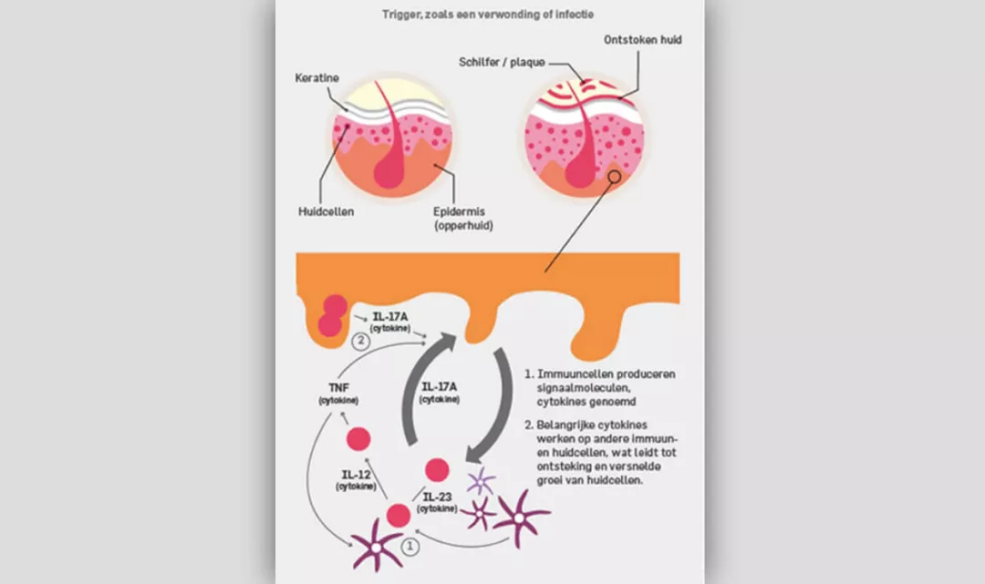 De rol van interleukine-17A