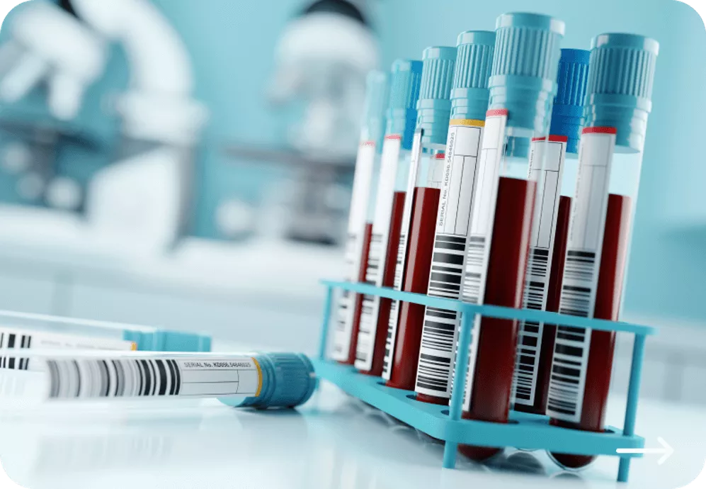 Waarom Lp(a) testen Novartis Cardiologie lipoproteine(a) 2.1