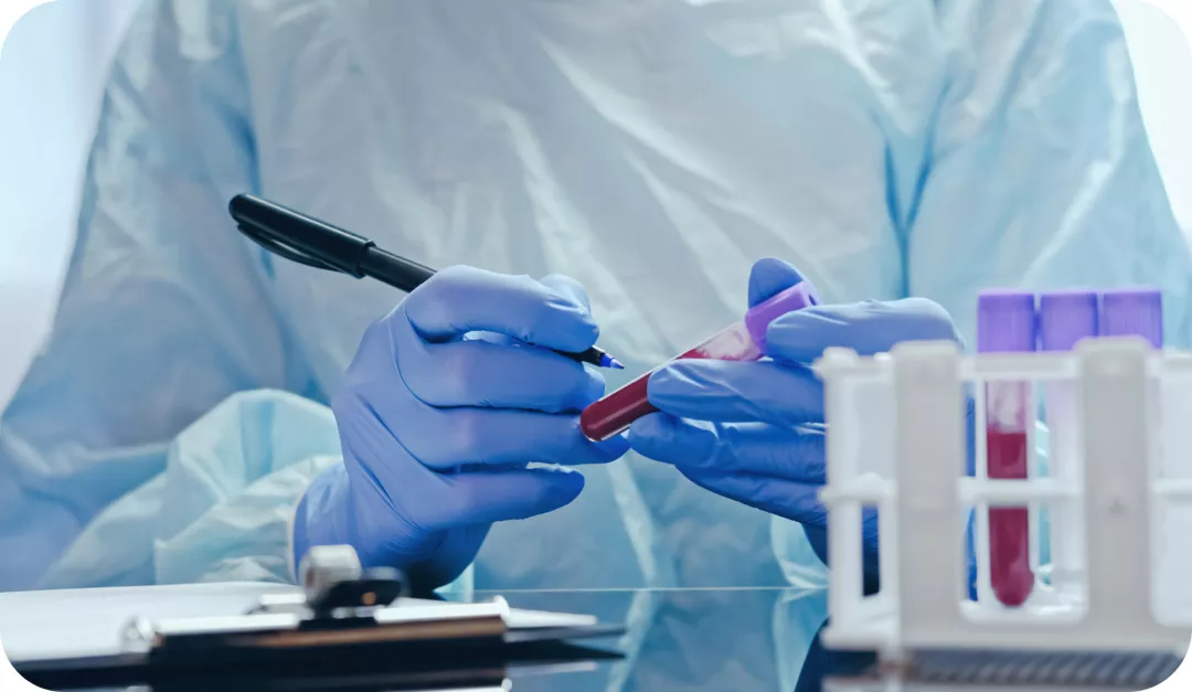 Lp(a) portal - hoe, waarom, wie Lipoproteïne-a testen Cardiologie Novartis