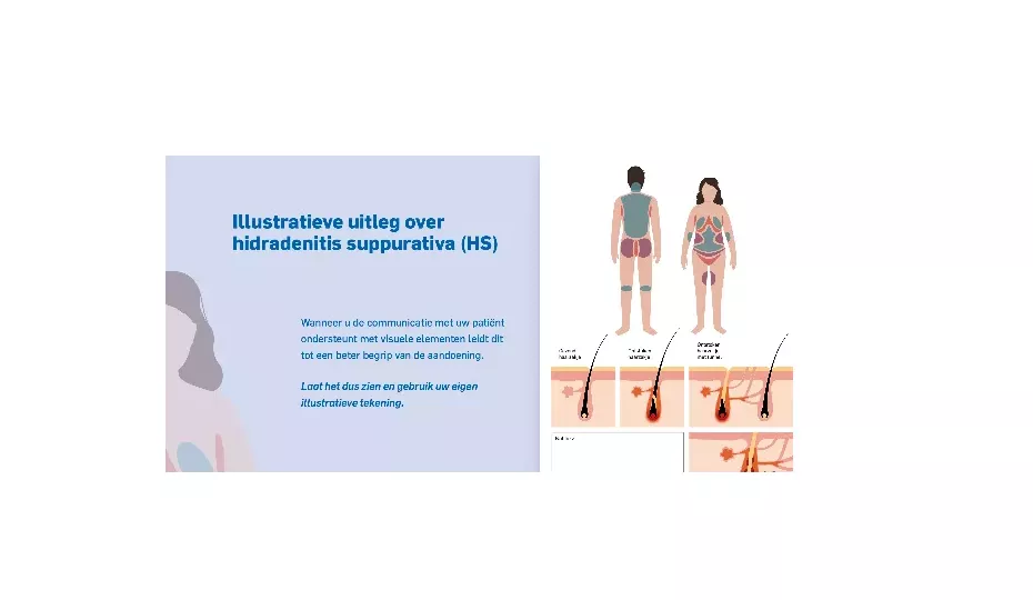 Ondersteunende materialen Cosentyx HS