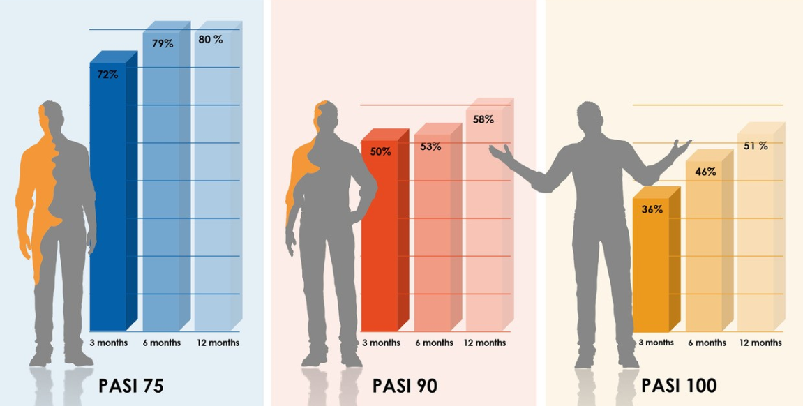 pasi.png pasi.png