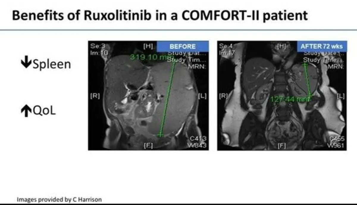 benefits.png benefits.png