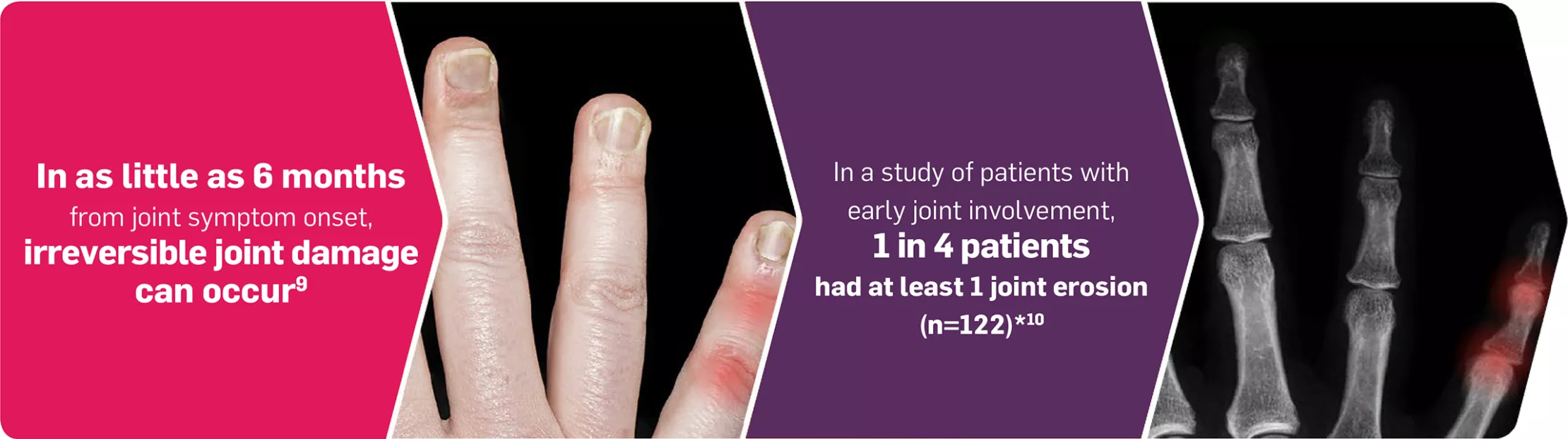 cos-derm-joint-damage-diagram cos-derm-joint-damage-diagram