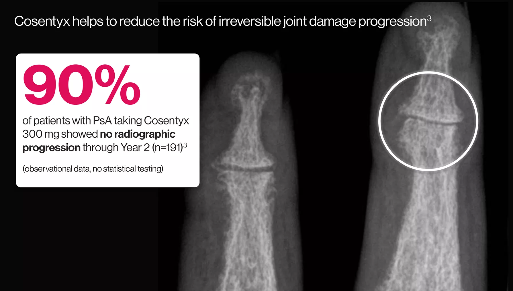 cos-derm-pso-psa-jointdamage cos-derm-pso-psa-jointdamage