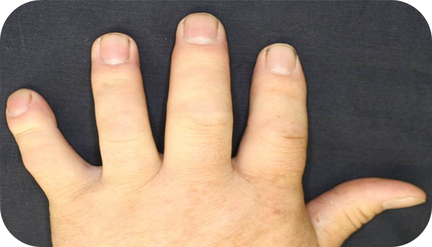 lzs_sztywnosc lzs_sztywnosc