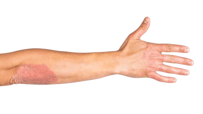 lzs-removebg-preview