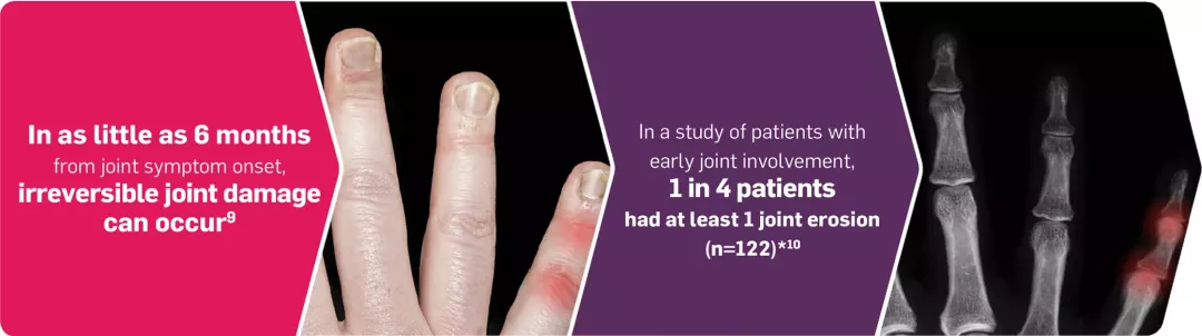 cos-derm-joint-damage-diagram