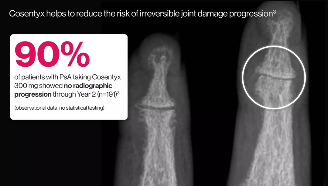 cos-derm-pso-psa-jointdamage
