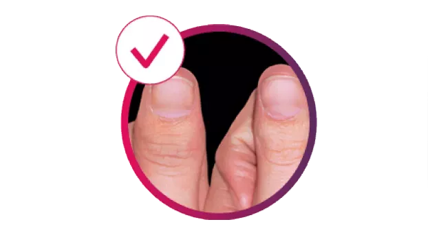 cosentyx-derm-Image_showing_Dactylitis_with_the_text_'88%'