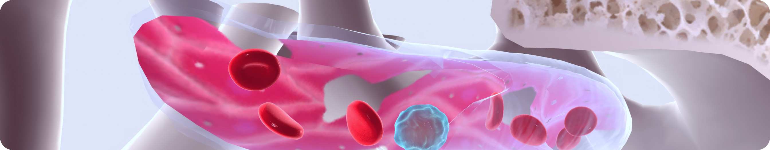 Как диагностировать псориатический артрит на раннем этапе