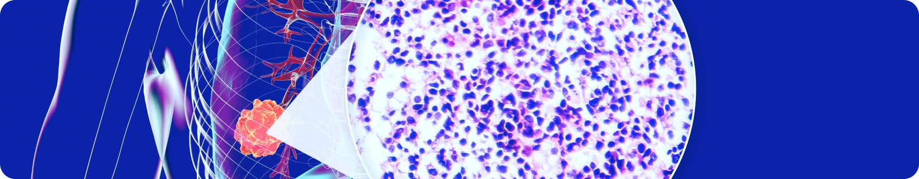 Показатели эффективности терапии церитинибом в исследовании