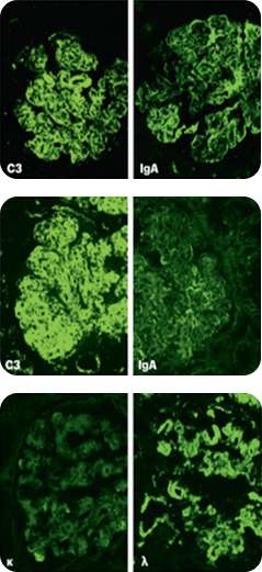 Иммунофлюоресцентный анализ в нефроморфологии Иммунофлюоресцентный анализ в нефроморфологии