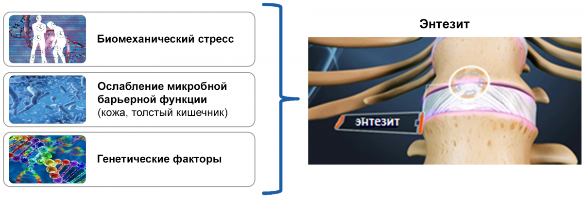 Комбинация механического и микробного факторов синергично активируют острый воспалительный ответ в энтезисах Комбинация механического и микробного факторов синергично активируют острый воспалительный ответ в энтезисах