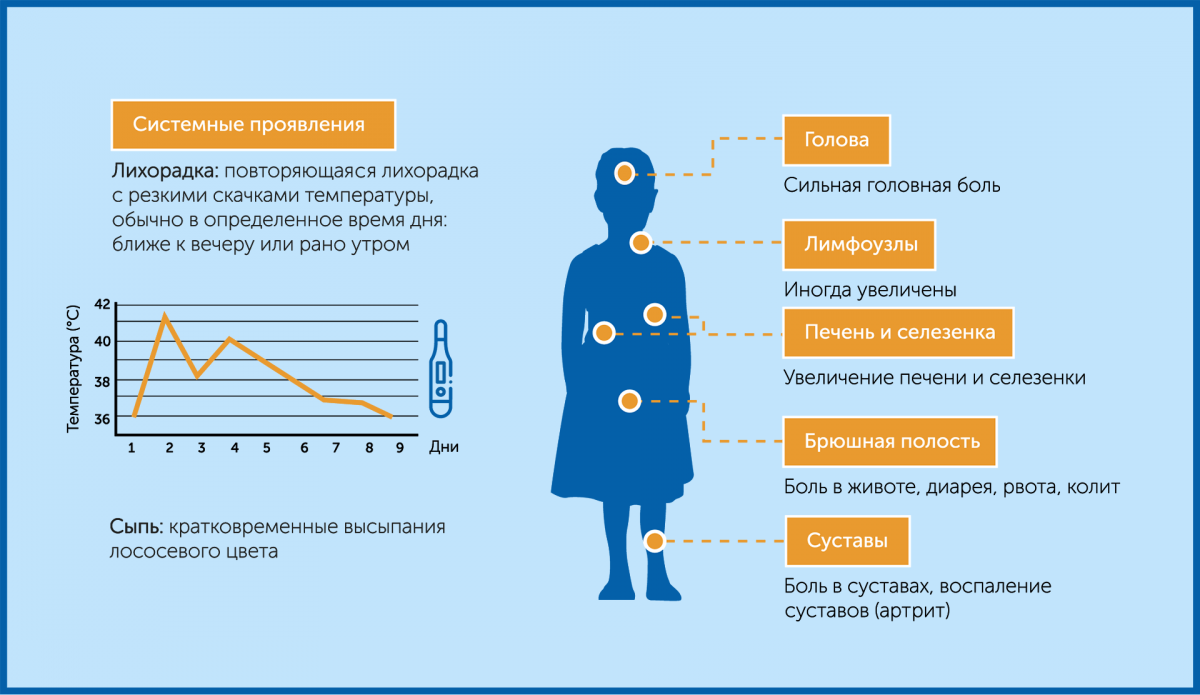 Основные симптомы сЮИА Основные симптомы сЮИА