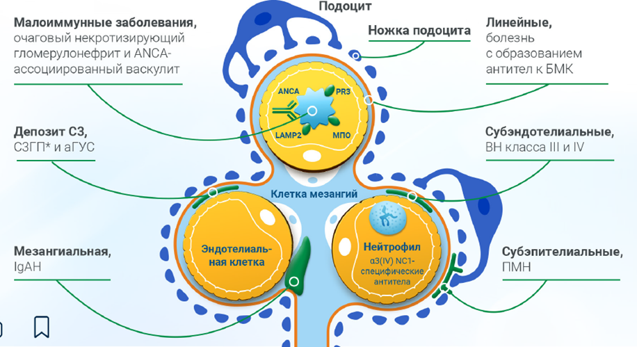 Приложение 2. Локализация отложений комплемента определяет характер почечной патологии9..png Приложение 2. Локализация отложений комплемента определяет характер почечной патологии9..png