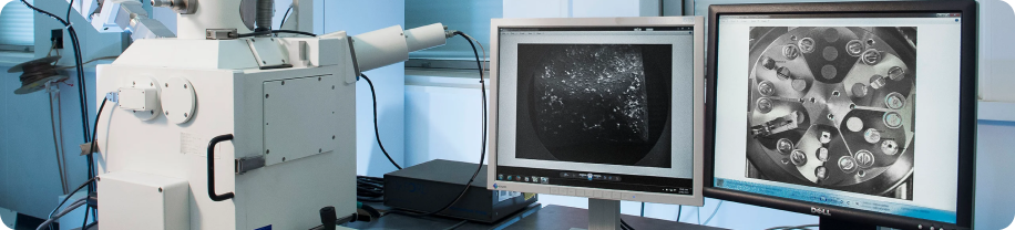 Примерно 25% биопсий требуют применения электронной микроскопии Примерно 25% биопсий требуют применения электронной микроскопии