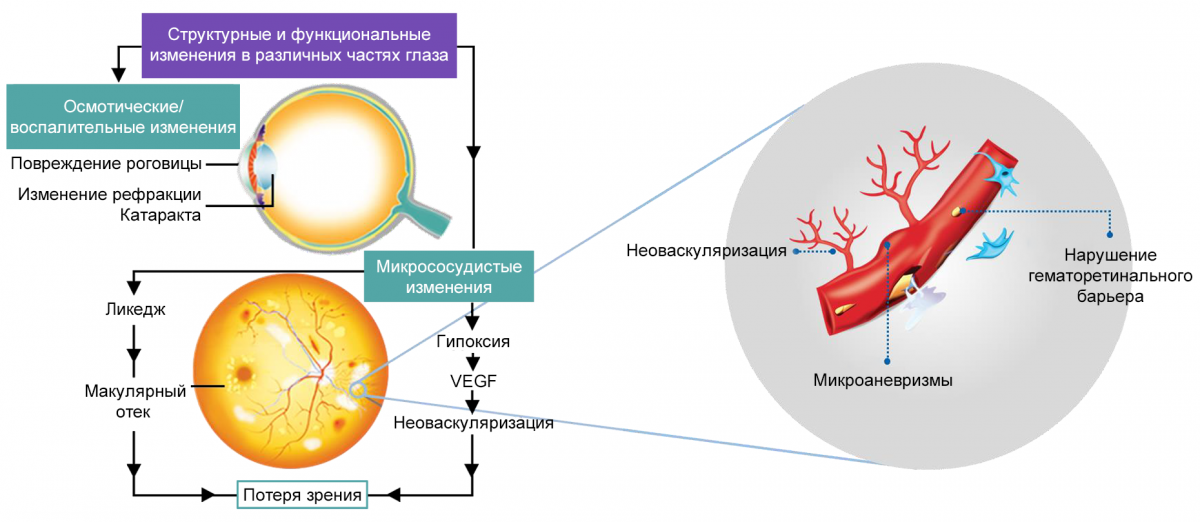 Рисунок 2. Патогенетические механизмы ДР Рисунок 2. Патогенетические механизмы ДР