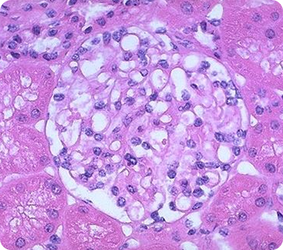 Световая микроскопия в нефрологии Световая микроскопия в нефрологии