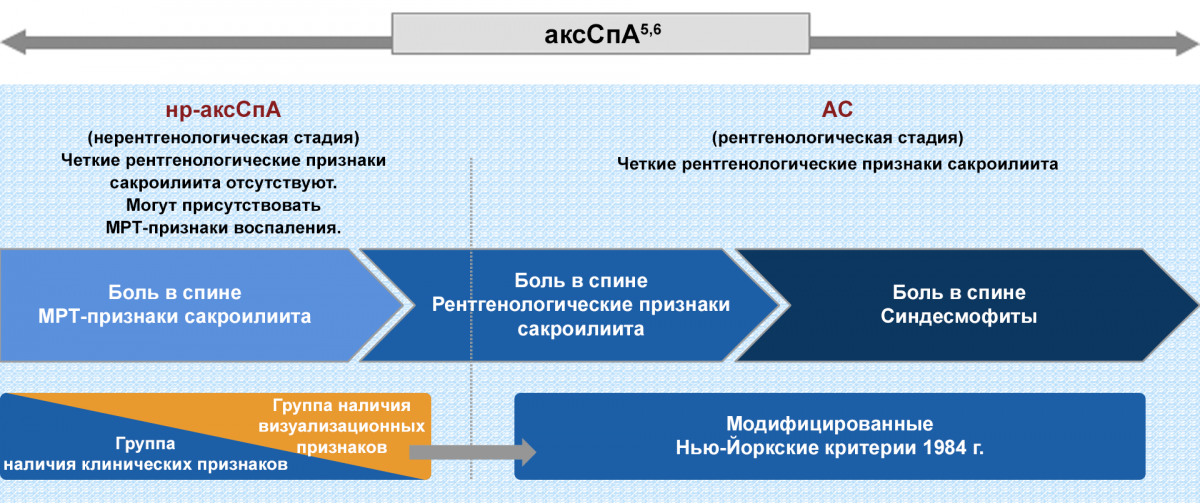 Спектр аксиального спондилоартрита (аксСпА) представлен формой без рентгенологических признаков (нр-аксСпА) и формой с рентгенологическими признаками (АС) Спектр аксиального спондилоартрита (аксСпА) представлен формой без рентгенологических признаков (нр-аксСпА) и формой с рентгенологическими признаками (АС)