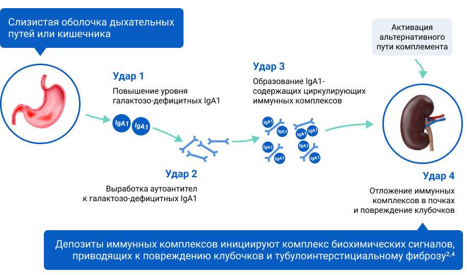 Существует гипотеза о четырехэтапном развитии IgA-нефропатии, в рамках которой предполагается активация пути комплемента Существует гипотеза о четырехэтапном развитии IgA-нефропатии, в рамках которой предполагается активация пути комплемента