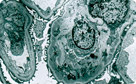 Электронная микроскопия в нефрологии Электронная микроскопия в нефрологии