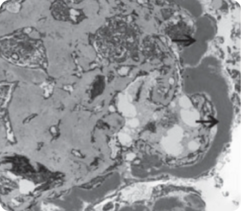 Электронная микроскопия Электронная микроскопия