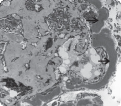 Электронная микроскопия Электронная микроскопия