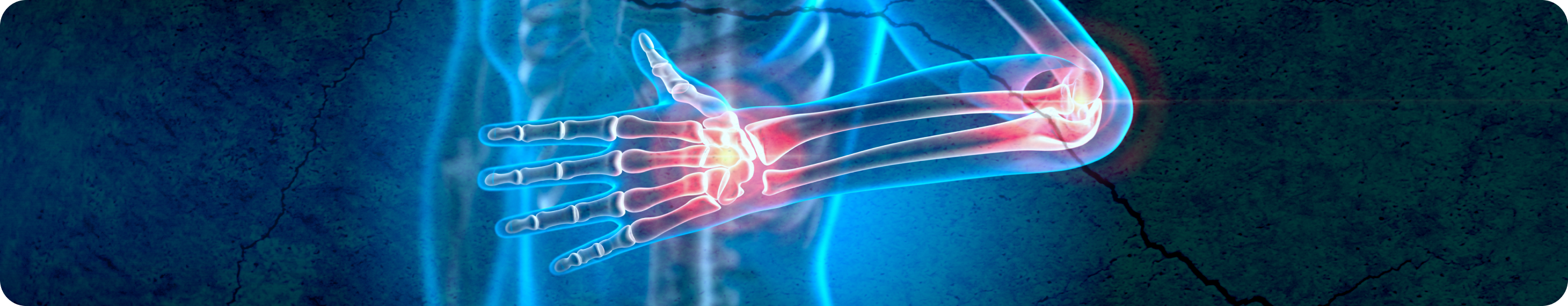 Ревматология