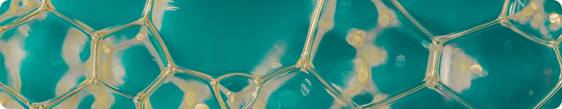 Актуальные подходы к выявлению артрита у пациентов с псориазом глазами дерматолога. Карамова А. Э.