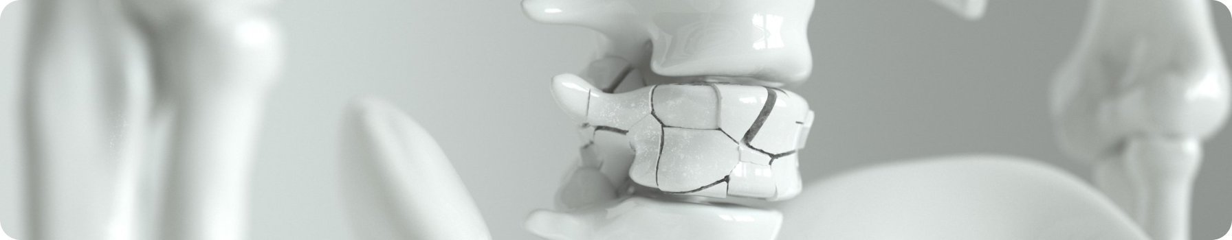 Коротаева Т.В. Основные тенденции диагностики и терапии поражения позвоночника при ПсА в России