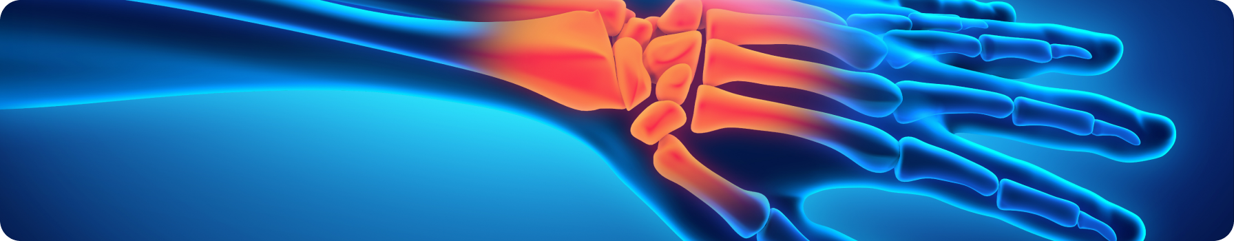 Дифференциальная диагностика аксильного ПсА глазами рентгенолога: основные ошибки и решения Смирнов А.В.