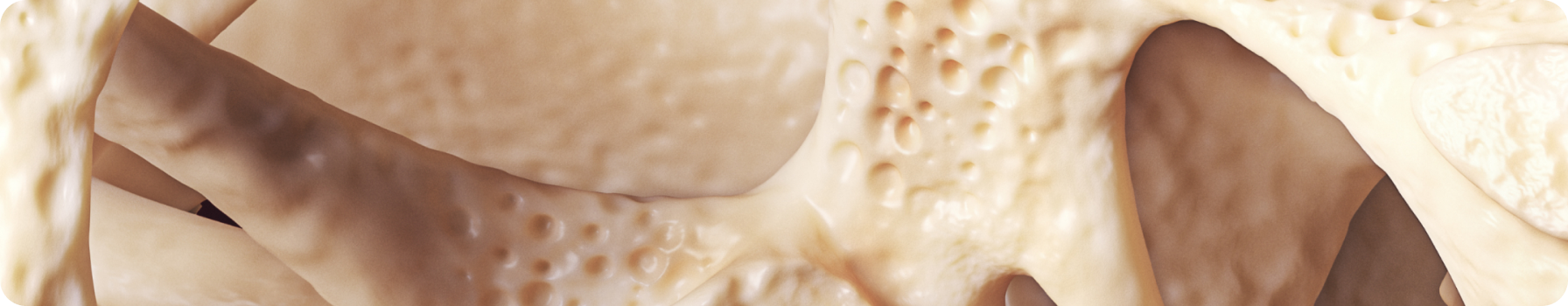 Псориатический артрит. Фокус на поражение ногтей