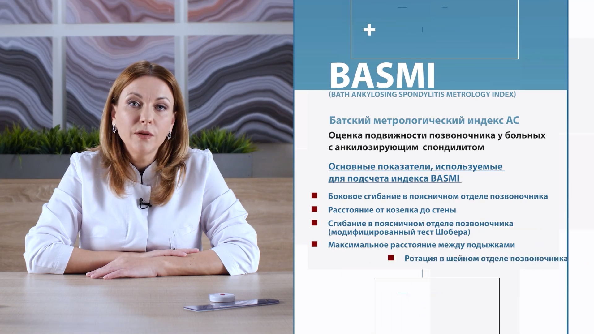 FireShot Capture 252 - Осмотр пациента с аксСпА - cdnapisec.kaltura.com__0.png