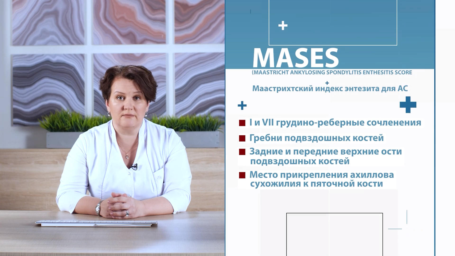 FireShot Capture 257 - Оценка энтезитов у пациента с аксСпА - cdnapisec.kaltura.com__0.png